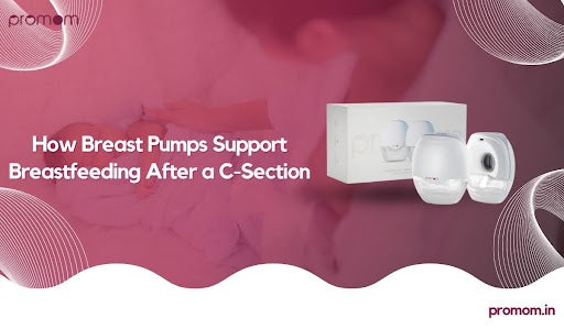How Breast Pumps Support Breastfeeding After a C-Section
